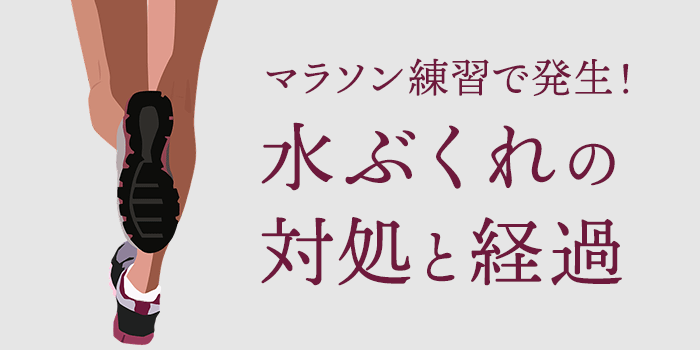 マラソン練習で水ぶくれが 発生から11日間の経過と対処法をご紹介 Nmrevolution Blog